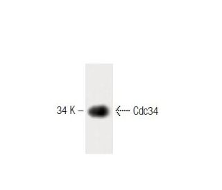 Cdc34 Antibody (17) - Western Blotting - Image 60261 