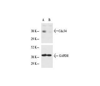 Cdc34 siRNA (h): sc-35042. Western blot analysis of Cdc34 expression in non-transfected control (A) and Cdc34 siRNA transf 