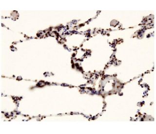 Cdc4 Antibody (3D1) - Immunohistochemistry - Image 351779 