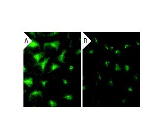 Cdc6 siRNA (h): sc-29258. Immunofluorescence staining of methanol-fixed, control HeLa (A) and Cdc6 siRNA silenced HeLa (B) 
