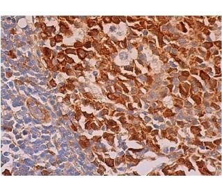Cdk1/Cdk2 Antibody (AN21.2) | SCBT - Santa Cruz Biotechnology