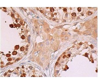 Cdk1/Cdk2 Antibody (AN21.2) | SCBT - Santa Cruz Biotechnology