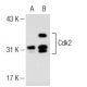 Cdk2 Antibody (55) - Western Blotting - Image 126644