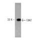 Cdk2 Antibody (55) - Western Blotting - Image 127495 