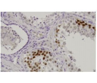 immunohistochemistry image from recommended Cdk3 (4B6) monoclonal antibody replacement. Image 35902