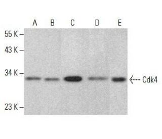 Cdk4 Antibody (0.N.199) - Western Blotting - Image 354035 