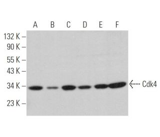 Cdk4 Antibody (3F121) - Western Blotting - Image 375919 