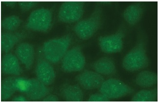 たろきち TIP60 Antibody (C-7) | SCBT - Santa Cruz Biotechnology