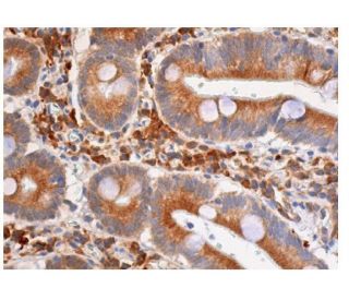 Cdk4 Antibody (B-10) | SCBT - Santa Cruz Biotechnology