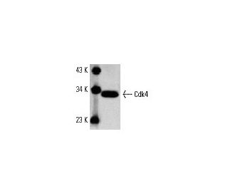 western blotting image from recommended Cdk4 (DCS-35) monoclonal antibody replacement. Image 6967