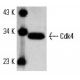 western blotting image from recommended Cdk4 (DCS-35) monoclonal antibody replacement. Image 6967