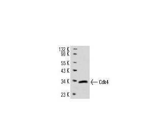 Cdk4 Antibody (DCS-156) - Western Blotting - Image 14316