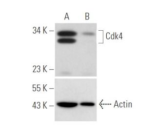 Cdk4 siRNA (h): sc-29261. Western blot analysis of Cdk4 expression in non-transfected control (A) and Cdk4 siRNA transfect 