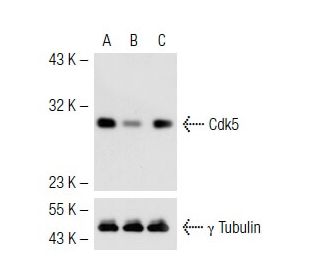 Cdk5 siRNA (h): sc-29263. Western blot analysis of human Cdk5 expression in non-transfected (A), Cdk5 siRNA Plasmid transf 