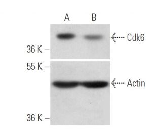 Cdk6 siRNA (h): sc-29264. Western blot analysis of Cdk6 expression in non-transfected control (A) and Cdk6 siRNA transfect 