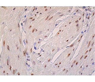 Cdk8 Antibody (D-9) | SCBT - Santa Cruz Biotechnology