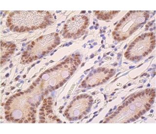 Cdk8 Antibody (D-9) | SCBT - Santa Cruz Biotechnology