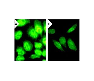 Cdk8 siRNA (h): sc-29267. Immunofluorescence staining of methanol-fixed, control HeLa (A) and Cdk8 siRNA silenced HeLa (B) 