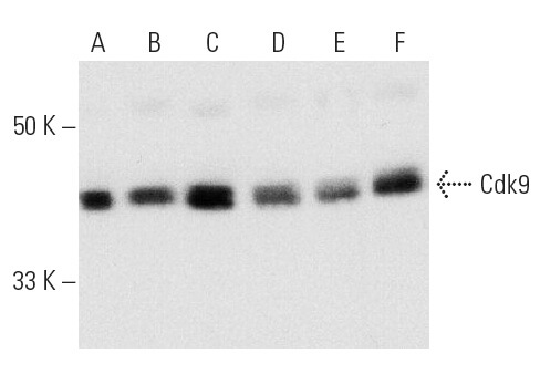 Cdk9 Antibody (D-7) | SCBT - Santa Cruz Biotechnology