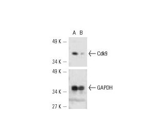 Cdk9 siRNA (h): sc-29268. Western blot analysis of Cdk9 expression in non-transfected control (A) and Cdk9 siRNA transfect 