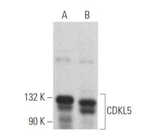CDKL5 Antibody (D-12) - Western Blotting - Image 366900 