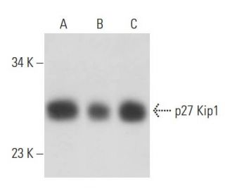 CDKN1B/Kip1 p27 Antibody (DCS-72) - Western Blotting - Image 15766