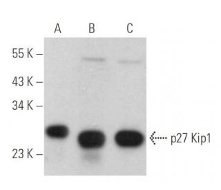 CDKN1B/Kip1 p27 Antibody (0.N.491) - Western Blotting - Image 380206