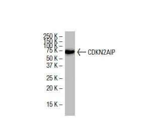 CDKN2AIP Antibody (18.7) - Western Blotting - Image 33486 