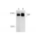 western blotting image from recommended CUTL1/CUX1/CDP (B-10) monoclonal antibody replacement. Image 314151