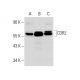 CDR2 Antibody (W-12) - Western Blotting - Image 304198 