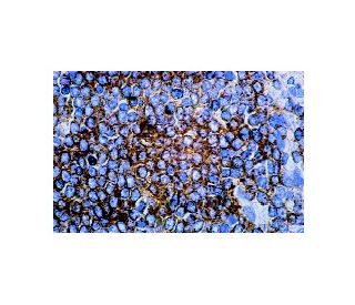 CDw75/ST6GAL1 Antibody (LN-1) - Immunohistochemistry - Image 8019 
