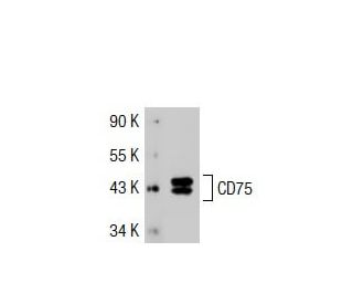 CDw75/ST6GAL1 Antibody (B-L5) - Western Blotting - Image 35243