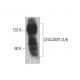 CEACAM1/3/6 Antibody (3H2379) - Western Blotting - Image 377972