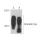 CEACAM1/3/6 Antibody (3H2379) - Western Blotting - Image 379966 