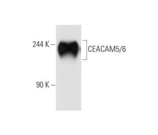 CEACAM5/6 Antibody (By114) - Western Blotting - Image 57582 