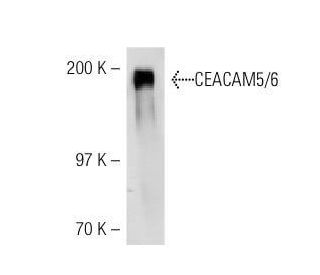 CEACAM5/6 Antibody (MUS) - Western Blotting - Image 21328 