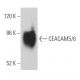CEACAM5/6 Antibody (MUS) - Western Blotting - Image 362811