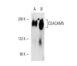 CEACAM5 Antibody (26/5/1) - Western Blotting - Image 14583 