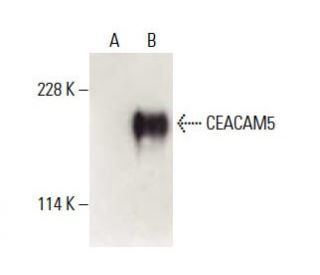 CEACAM5 Antibody (CI-P83-1) - Western Blotting - Image 397929
