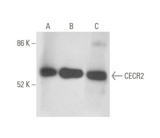 CECR2 Antibody (C-3) - Western Blotting - Image 333456 