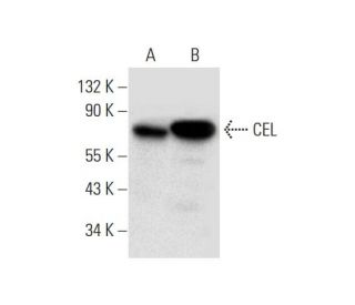 CEL Antibody (E-4) - Western Blotting - Image 299038 