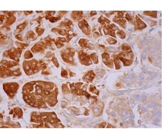 CEL Antibody (G-12) - Immunohistochemistry - Image 293482 