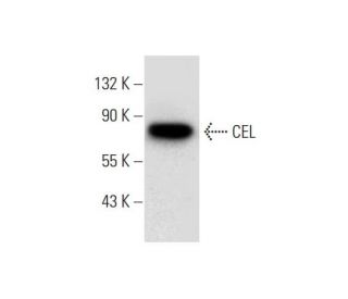 CEL Antibody (H-12) - Western Blotting - Image 299039 