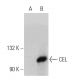 CEL Antibody (H-12) - Western Blotting - Image 359918