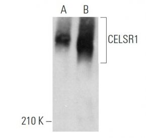 CELSR1 Antibody (E-3) - Western Blotting - Image 371644 