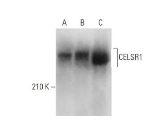 CELSR1 Antibody (E-3) - Western Blotting - Image 318578SAM Transcription Activation: SAM system utilizing dCas9-VP64, MS2-P65-HSF1, and sgRNA for precise gene transcription activation.