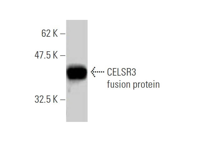 CELSR3 Antibody (2F7) | SCBT - Santa Cruz Biotechnology
