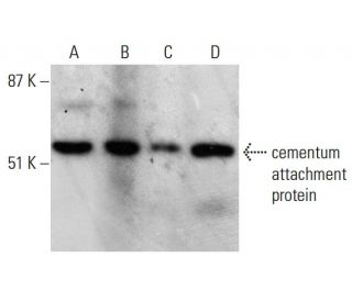 cementum attachment protein Antibody (3G9) - Western Blotting - Image 388037 