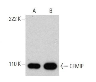 CEMIP Antibody (3C12) - Western Blotting - Image 368272 