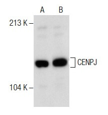 激安価格の (E-12) Antibody CENPJ | Biotechnology Cruz Santa - SCBT コスプレ衣装